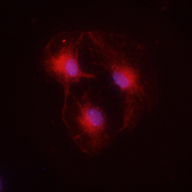 CXCR4 antibody in Mouse Neural Progenitor Cells by Immunocytochemistry (ICC).