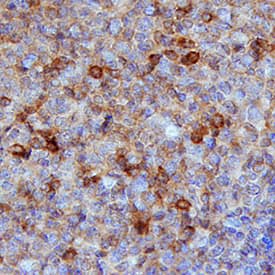 CXCR5 antibody in Human Tonsil by Immunohistochemistry (IHC-P).