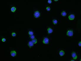 CXCR5 antibody in A20 Mouse Cell Line by Immunocytochemistry (ICC).