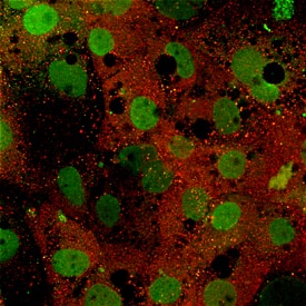 CYP7A1 antibody in Human Hepatocytes by Immunocytochemistry (ICC).