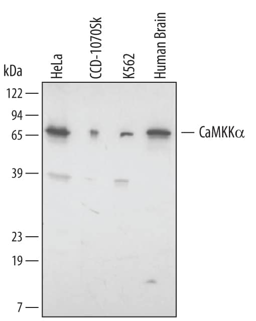 Detection of Human/Rat CaMKKa antibody by Western Blot.