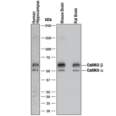 Detection of Human, Mouse, and Rat CaM Kinase II antibody by Western Blot.