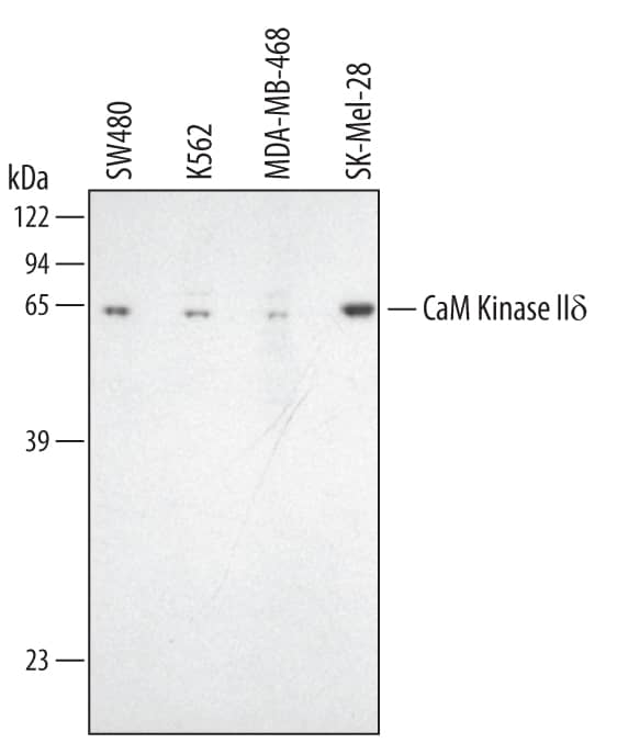 Detection of Human CaM Kinase IId antibody by Western Blot.