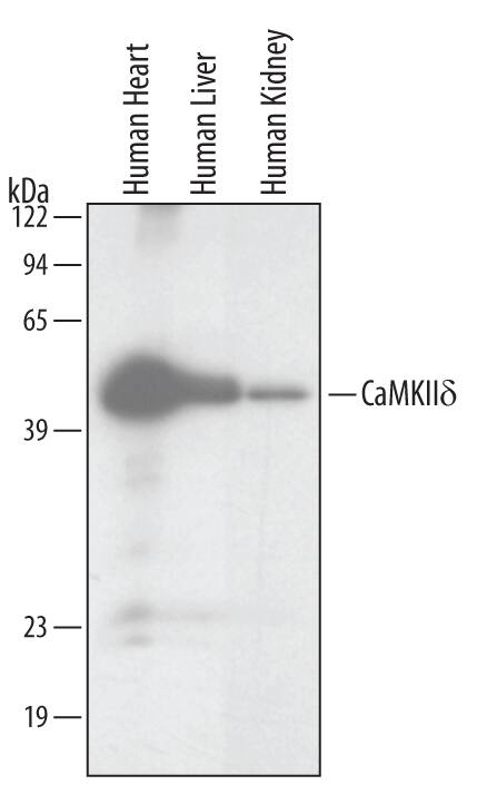 Detection of Human CaM Kinase IId antibody by Western Blot.