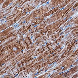 CaM Kinase II antibody in Human Heart by Immunohistochemistry (IHC-P).