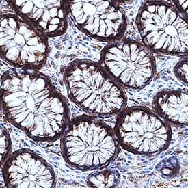 CaM Kinase II antibody in Human Intestine by Immunohistochemistry (IHC-P).