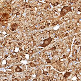 CaM Kinase II antibody in Mouse Brain by Immunohistochemistry (IHC-Fr).
