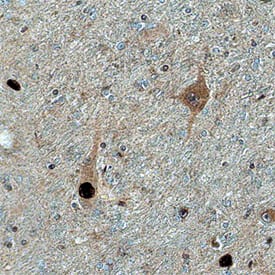 CaM Kinase Ia antibody in Human Hypothalamus by Immunohistochemistry (IHC-P).