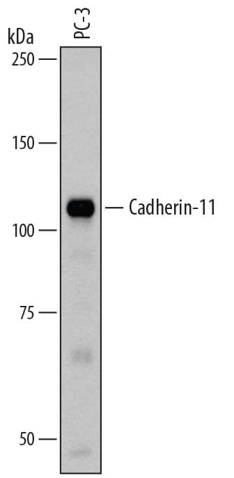 Detection of Human Cadherin-11 antibody by Western Blot.