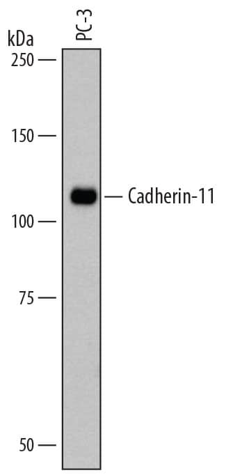 Detection of Human Cadherin-11 antibody by Western Blot.