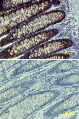 Cadherin-17 antibody in Human Colon by Immunohistochemistry (IHC-P).