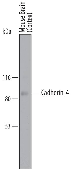 Detection of Mouse Cadherin-4/R-Cadherin antibody by Western Blot.