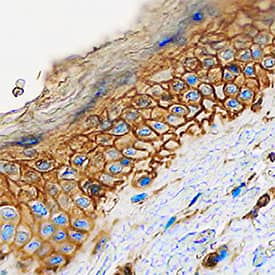 Cadherin-13 antibody in Human Skin by Immunohistochemistry (IHC-P).