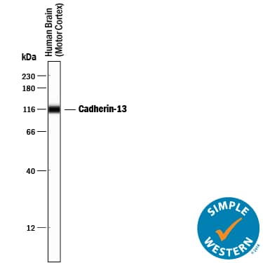 Detection of Human Cadherin-13 antibody by Simple WesternTM.