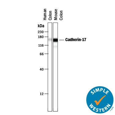 Detection of Human and Mouse Cadherin-17 antibody by Simple WesternTM.
