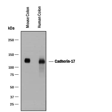 Detection of Human and Mouse Cadherin-17 antibody by Western Blot.