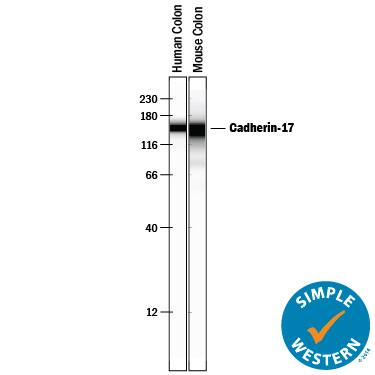 Detection of Human and mouse Cadherin-17 antibody by Simple WesternTM.