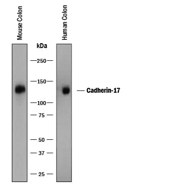 Detection of Human and Mouse Cadherin-17 antibody by Western Blot.