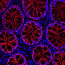 Cadherin-17 antibody in Human Ascending Colon by Immunohistochemistry (IHC-P).