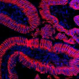 Cadherin-17 antibody in Mouse Intestine by Immunohistochemistry (IHC-Fr).