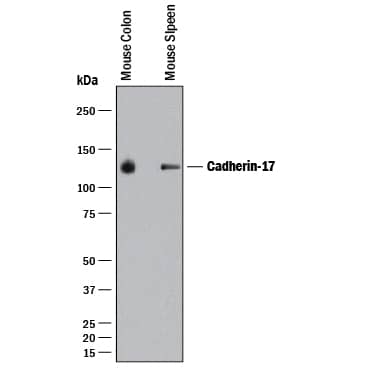 Detection of Mouse Cadherin-17 antibody by Western Blot.