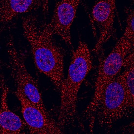 Cadherin-6/KCAD antibody in MG-63 Human Cell Line by Immunocytochemistry (ICC).