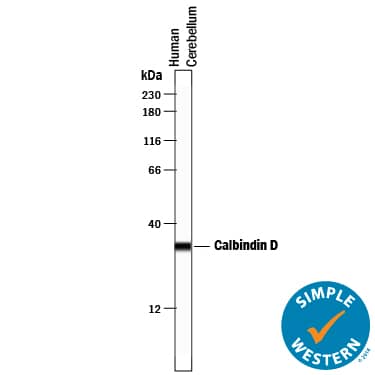 Detection of Human Calbindin D antibody by Simple WesternTM.