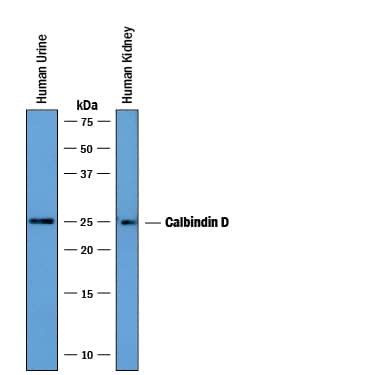 Detection of Human Calbindin D antibody by Western Blot.