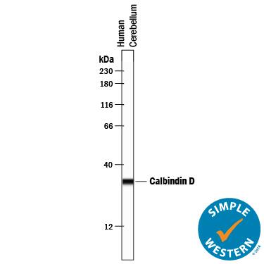 Detection of Human Calbindin D antibody by Simple WesternTM.