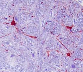 Calbindin D antibody in Rat Brainstem by Immunohistochemistry (IHC-P).