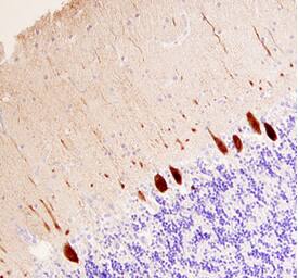 Calbindin D antibody in Human Brain by Immunohistochemistry (IHC-P).