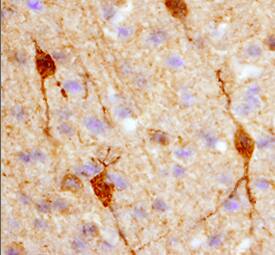 Calbindin D antibody in Rat Brain by Immunohistochemistry (IHC-Fr).