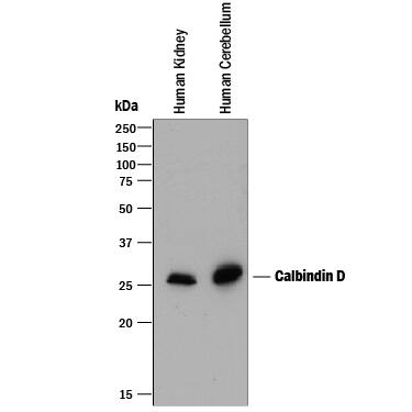 Detection of Human Calbindin D antibody by Western Blot.