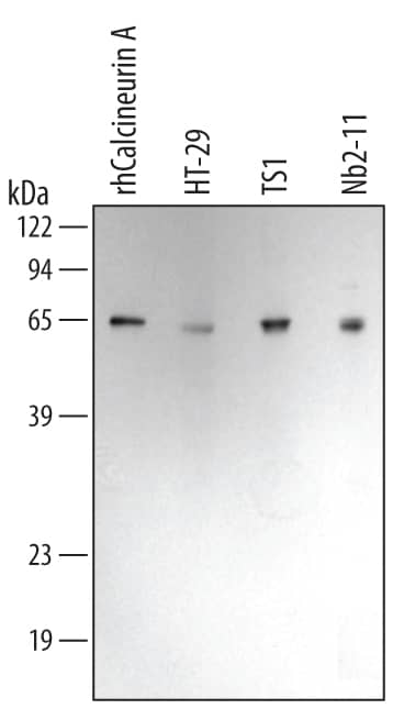 Detection of Human/Mouse/Rat Calcineurin A antibody by Western Blot.