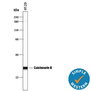 Detection of Human Calcineurin B antibody by Simple WesternTM.