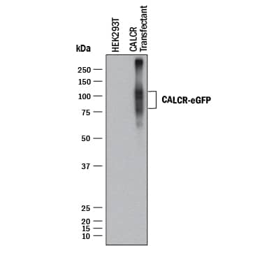 Detection of Human Calcitonin R antibody by Western Blot.