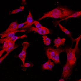 Calponin 1 antibody in MDA-MB-231 Human Cell Line by Immunocytochemistry (ICC).