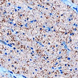 Calponin 1 antibody in Human Small Intestine by Immunohistochemistry (IHC-P).