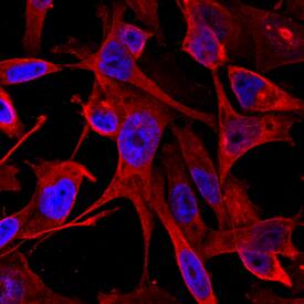 Calponin 1 antibody in MDA-MD-231 Human Cell Line by Immunocytochemistry (ICC).