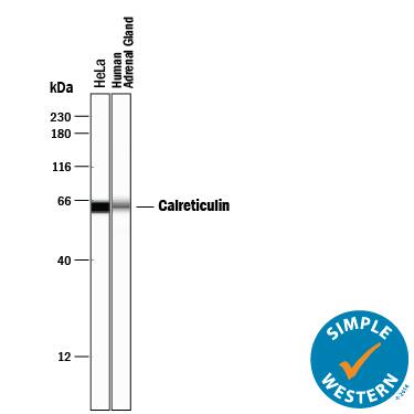 Detection of Human Calreticulin antibody by Simple WesternTM.