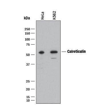 Detection of Human Calreticulin antibody by Western Blot.