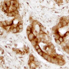 Calreticulin antibody in Human Prostate by Immunohistochemistry (IHC-P).