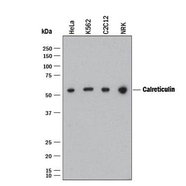 Detection of Human, Mouse, and Rat Calreticulin antibody by Western Blot.