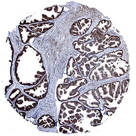 Calreticulin antibody in Human Prostate by Immunohistochemistry (IHC-P).