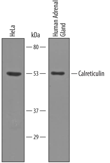 Detection of Human Calreticulin antibody by Western Blot.