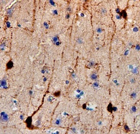 Calretinin antibody in Human Brain by Immunohistochemistry (IHC-P).