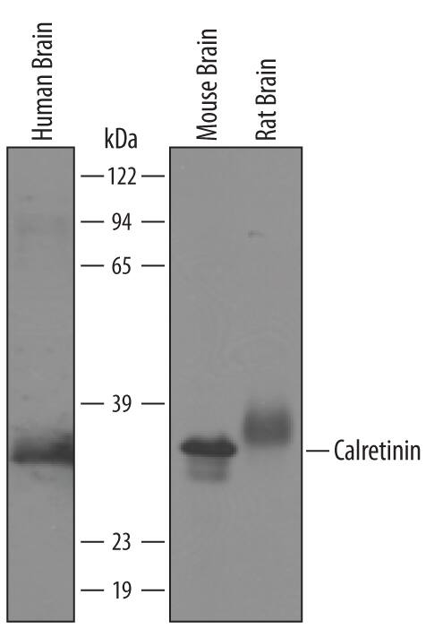 Detection of Human/Mouse/Rat Calretinin antibody by Western Blot.