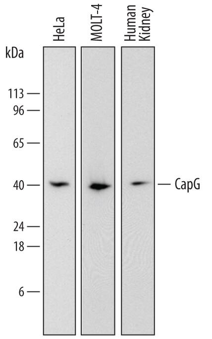 Detection of Human CapG antibody by Western Blot.