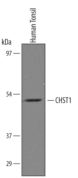 Detection of Human Carbohydrate Sulfotransferase 1/CHST1 antibody by Western Blot.