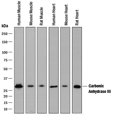 Detection of Human, Mouse, and Rat Carbonic Anhydrase III/CA3 antibody by Western Blot.